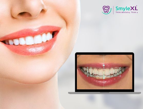 Smile Designing Treatment in Nashik Road Nashik