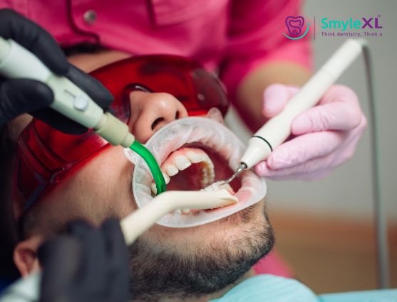 Teeth Cleaning Treatment in Nashik Road Nashik