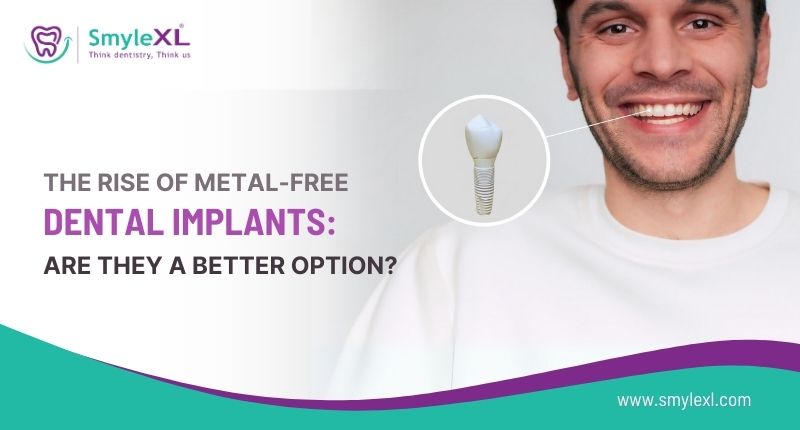 The Rise of Metal-Free Dental Implants: Are They a Better Option?