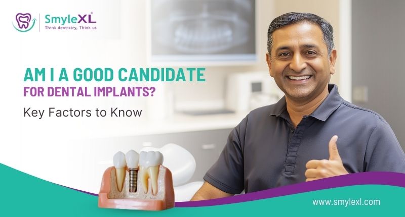 Am I a Good Candidate for Dental Implants? Key Factors to Know