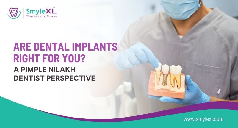 Are Dental Implants Right for You? A Pimple Nilakh Dentist’s Perspective