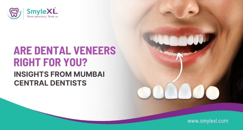 Are Dental Veneers Right for You? Insights from Mumbai Central Dentists