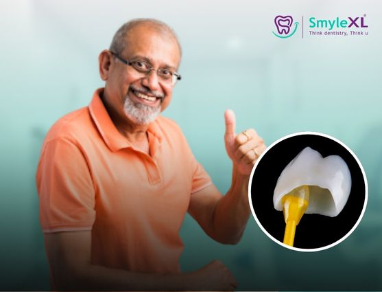 Crown and Bridge Treatment in Lal Darwaja Surat