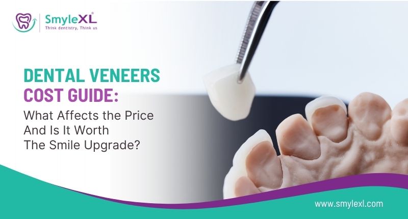 Dental Veneers Cost Guide: What Affects the Price and Is It Worth the Smile Upgrade?