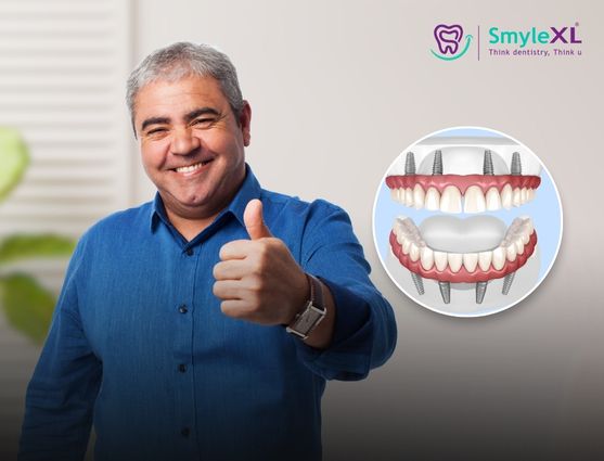 full mouth restoration in nashik road