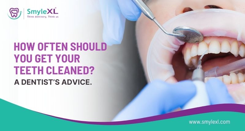How Often Should You Get Your Teeth Cleaned? A Dentist’s Advice
