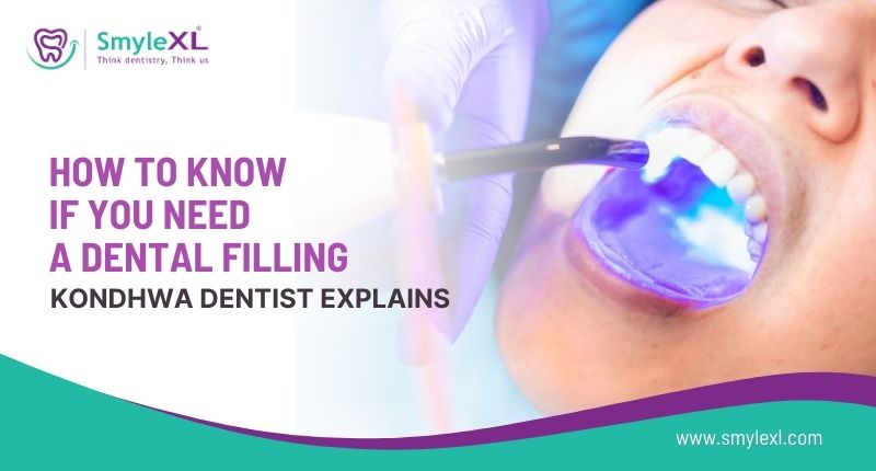 How to Know If You Need a Dental Filling: Kondhwa Dentist Explains