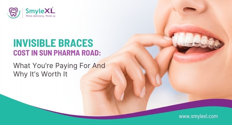 Invisible Braces Cost in Sun Pharma Road: What You’re Paying For and Why It’s Worth It