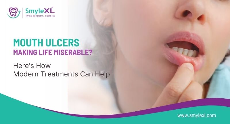 Mouth Ulcers Making Life Miserable? Here’s How Modern Treatments Can Help