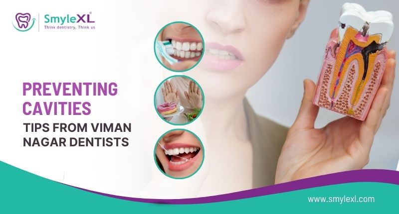 Preventing Cavities: Tips from Viman Nagar Dentists