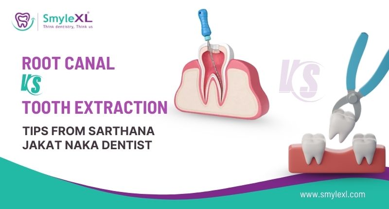 Root Canal vs. Tooth Extraction: Tips From Sarthana Jakat Naka Dentist