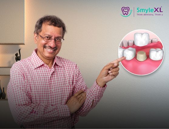 full mouth restoration in ahmednagar