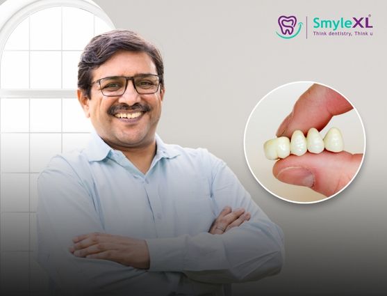 full mouth restoration in kondhwa