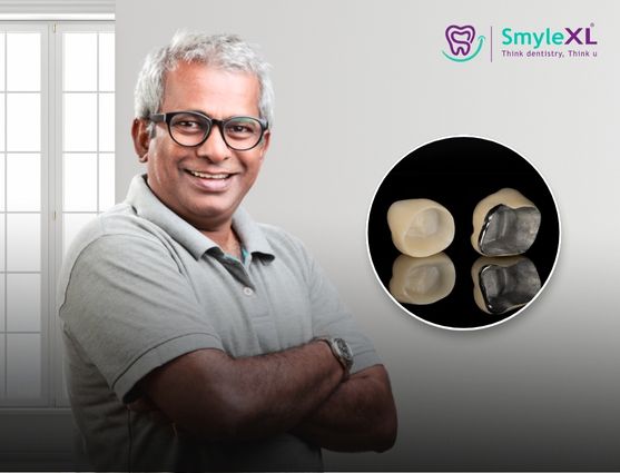 full mouth restoration in nallagandla