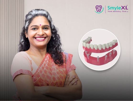 full mouth restoration in sarthana jakat naka surat