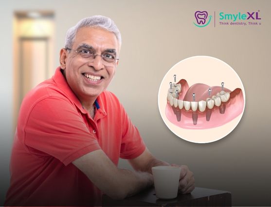 full mouth restoration in sinhagad road