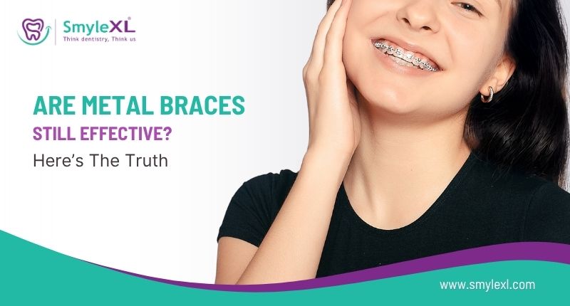 Are Metal Braces Still Effective? Here’s the Truth