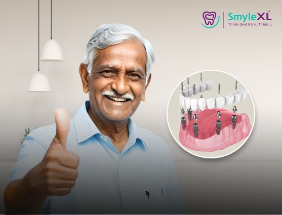 Full Mouth Restoration in Vanasthalipuram