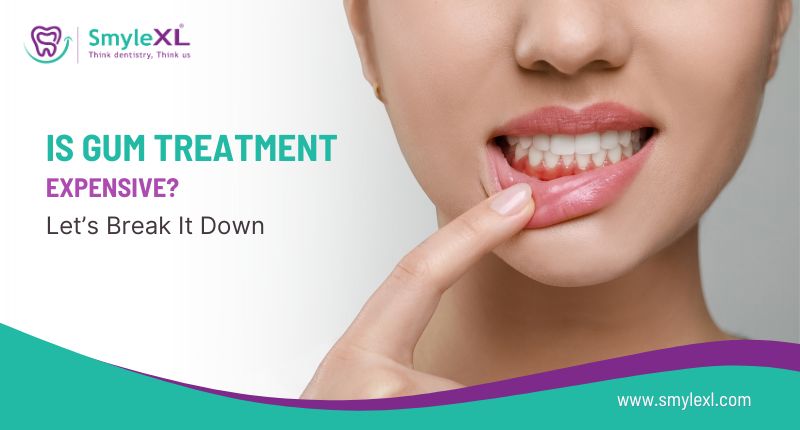 Is Gum Treatment Expensive? Let’s Break It Down