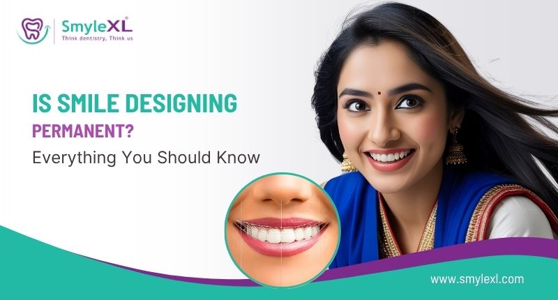 Is Smile Designing Permanent? Everything You Should Know