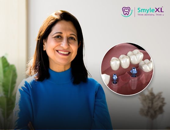 full mouth restoration in dwaraka nagar