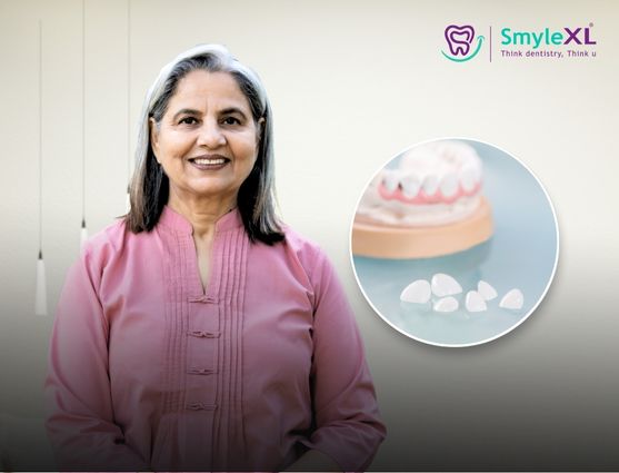 full mouth restoration in kolhapur