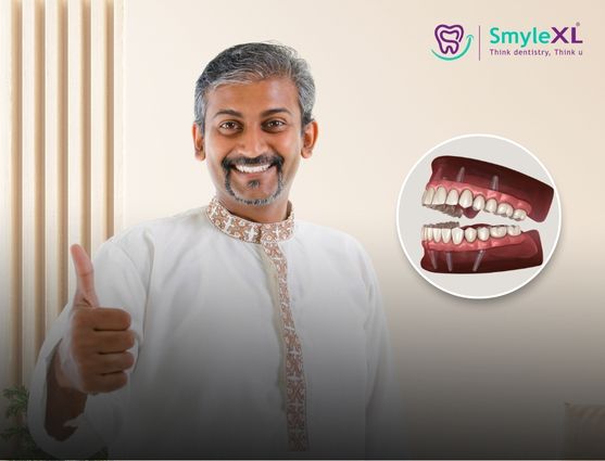 full mouth restoration in kothrud