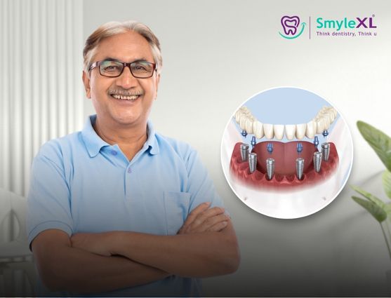 full mouth restoration in mumbai central