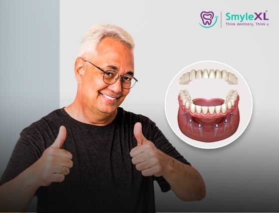 full mouth restoration in phaltan