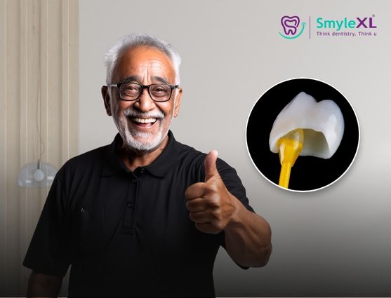 full mouth restoration in rmv bengaluru