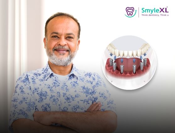 full mouth restoration in sun pharma road
