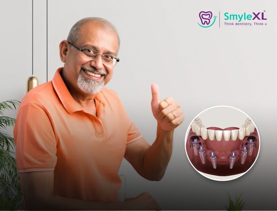 full mouth restoration in viman nagar