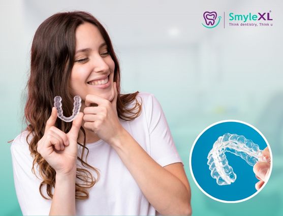 Invisible Braces in India