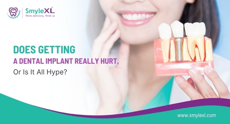 Does Getting a Dental Implant Really Hurt, or Is It All Hype?
