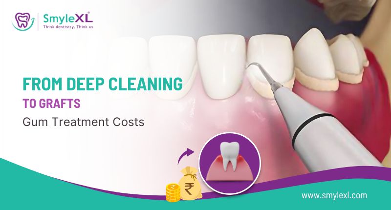 From Deep Cleaning to Grafts: Gum Treatment Costs Explained
