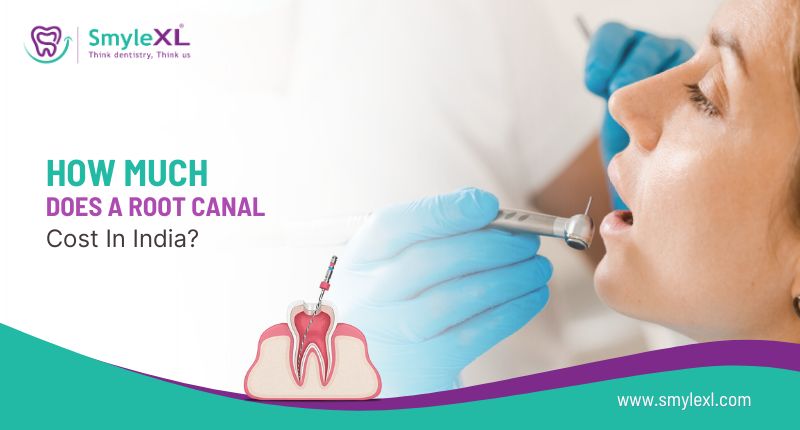 How much does a root canal cost in India?
