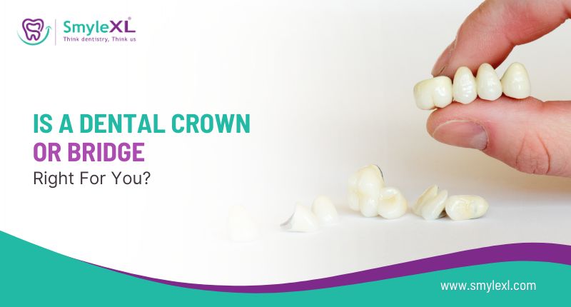 Is a Dental Crown or Bridge Right for You?