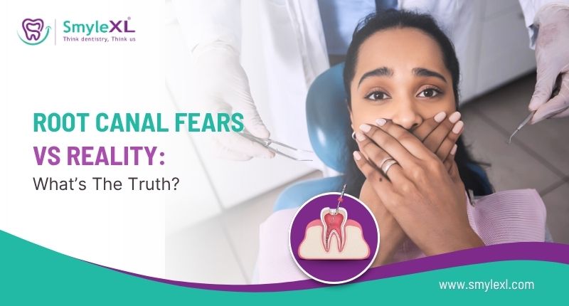 Root Canal Fears vs Reality: What’s the Truth?