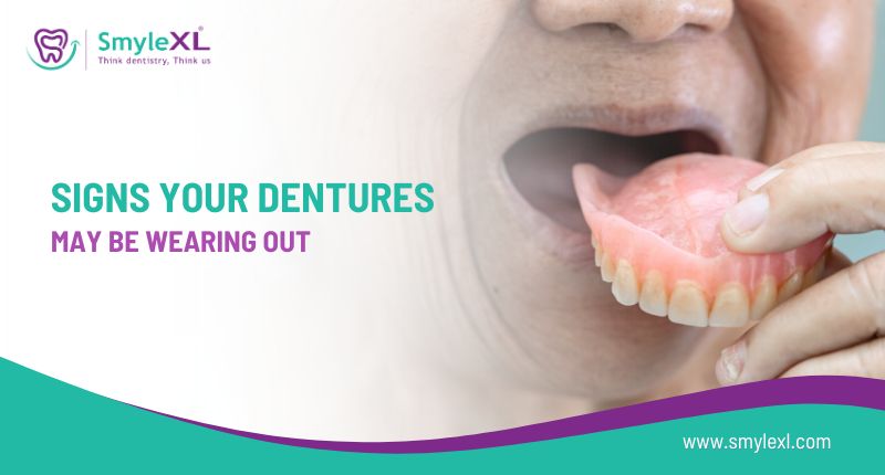 Signs Your Dentures May Be Wearing Out