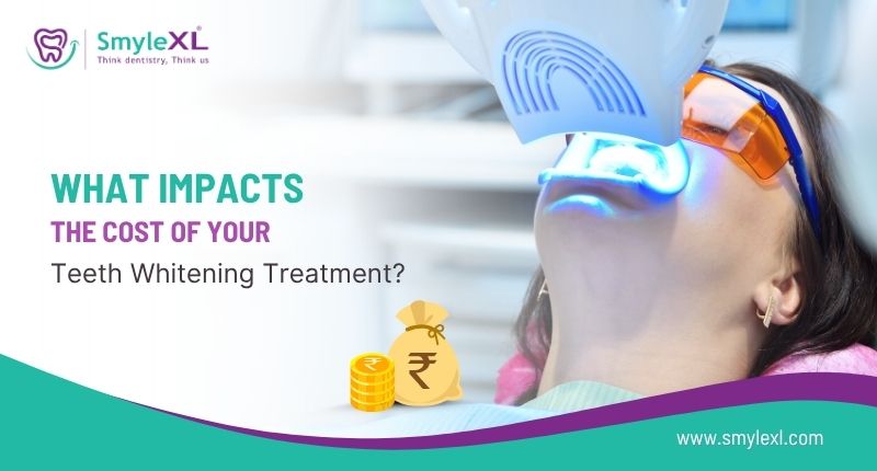 What Impacts the Cost of Your Teeth Whitening Treatment?