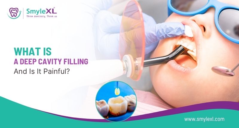 What is a Deep Cavity Filling and Is It Painful?