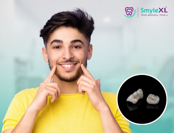 dental crown and bridge treatment in india