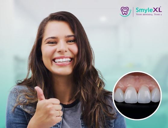 smile makeover treatment in india