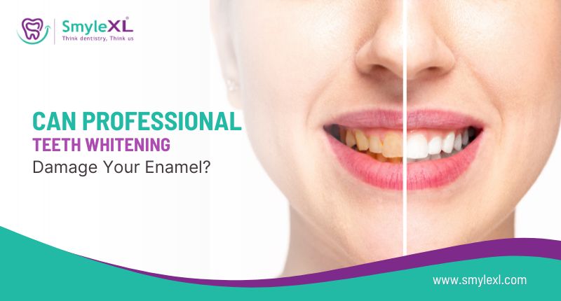 Can Professional Teeth Whitening Damage Your Enamel?