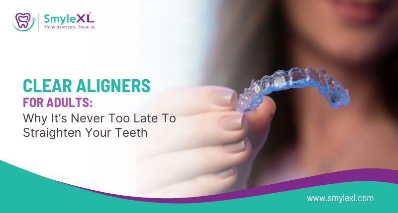 Clear Aligners for Adults: Why It’s Never Too Late to Straighten Your Teeth