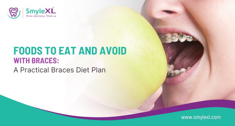 Foods to Eat and Avoid with Braces: A Practical Braces Diet Plan