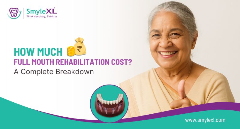 How Much Full Mouth Restoration Cost? A Complete Breakdown