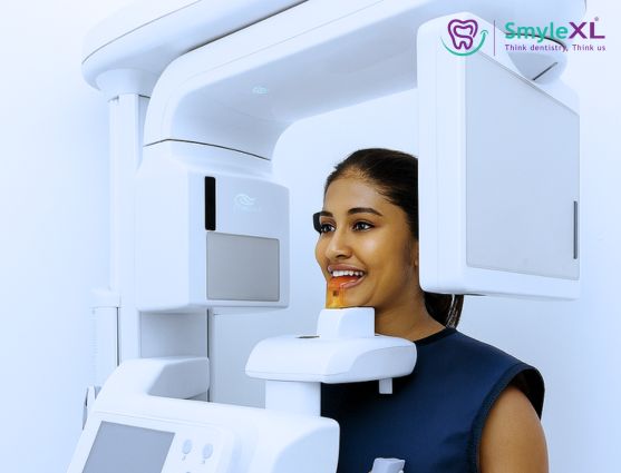 CBCT Scan Center in Sarthana Jakat Naka Surat