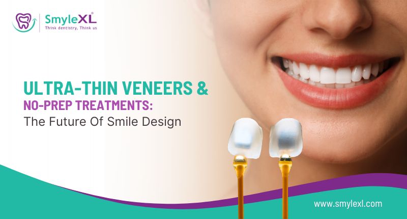 Ultra-Thin Veneers & No-Prep Treatments: The Future of Smile Design