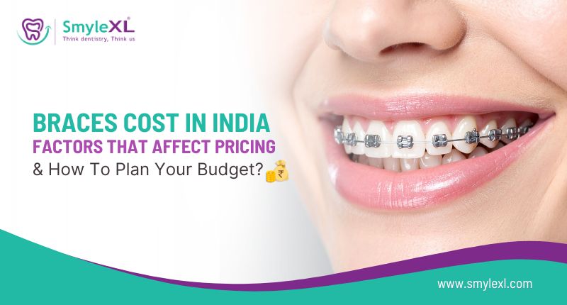 Braces Cost in India: Factors That Affect Pricing & How to Plan Your Budget